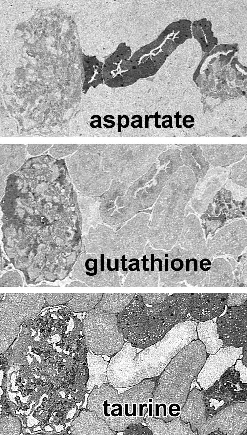 Rabbit kidney renal visualize taurine and aspartate glutathione signals