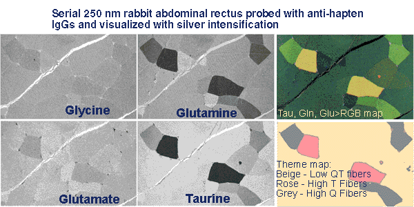 Rabbit skeletal muscle visualize glutamate, glutamine, taurine and glycine signals