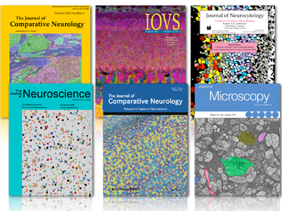 journal cover articles featuring Signature Immunologics antibodies products: alanine, agamatine (AGB), glutamate, glutathione, glycine, glutamine, GABA, taurine, aspartate